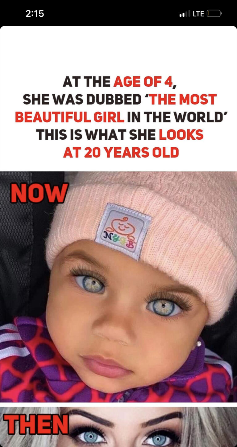 At the age of 4, she was dubbed ‘the most beautiful girl in the world’ – This is what she looks at 20 years old