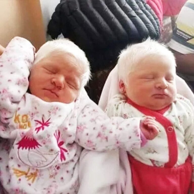 The First Ever Albino Twins Born In Argentina Will Leave You In Awe