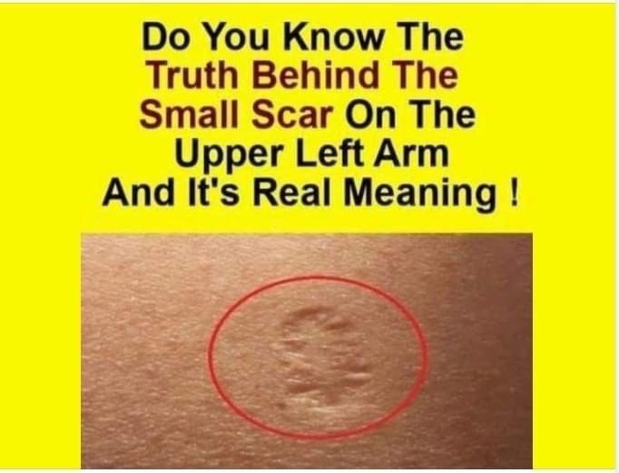 Do You Know The Real Significance Of The Small Scar On The Upper Left Arm