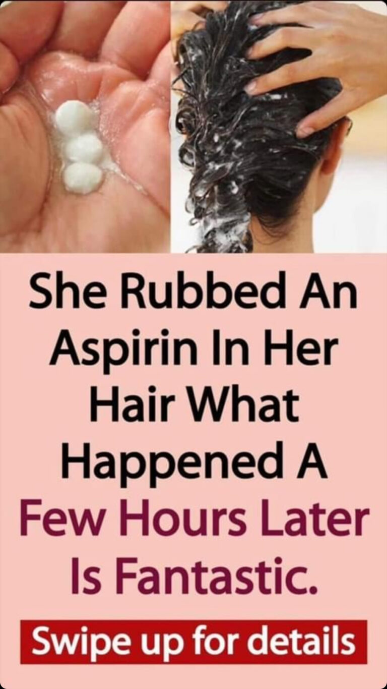 Take aspirin to get rid of dandruff