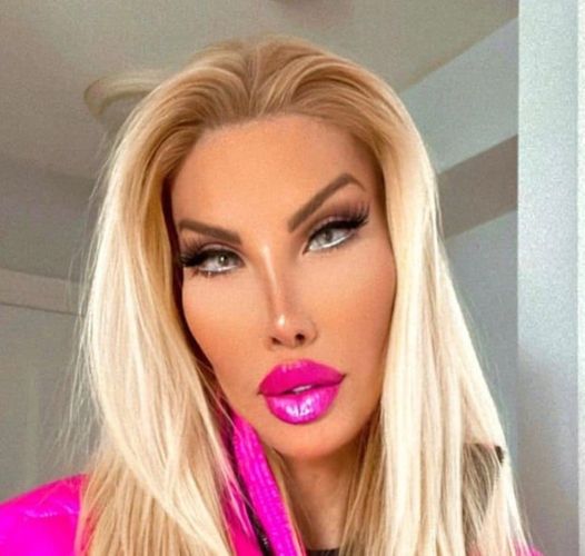 Transgender woman spent millions to achieve Barbie-like appearance: What does her “human Ken doll” boyfriend look like?