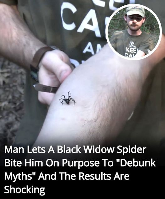 To Dispel Myths About Arachnids, A Wildlife Enthusiast Lets A Black Widow Bite Him.