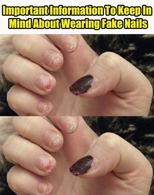 Crucial Reminders Regarding the Use of Artificial Nails