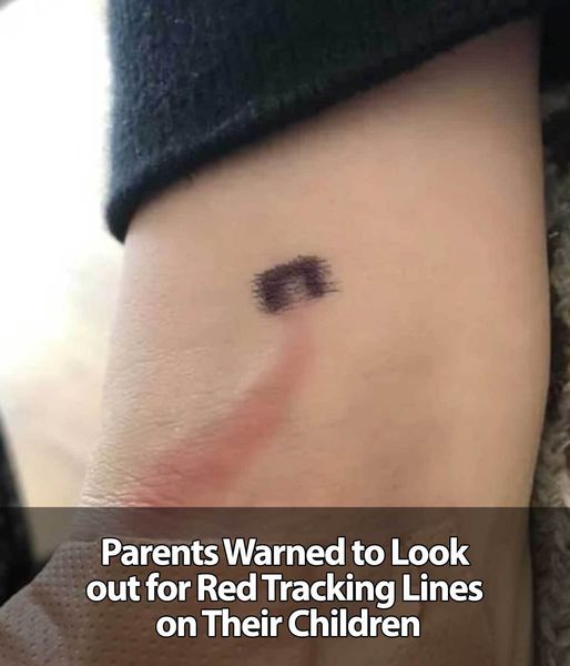 Parents, Be Aware of Your Kids’ Red Tracking Lines