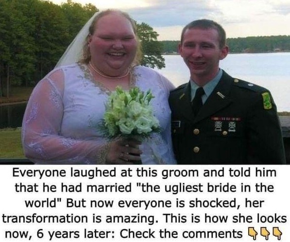 People called her ‘the ugliest bride in the world’