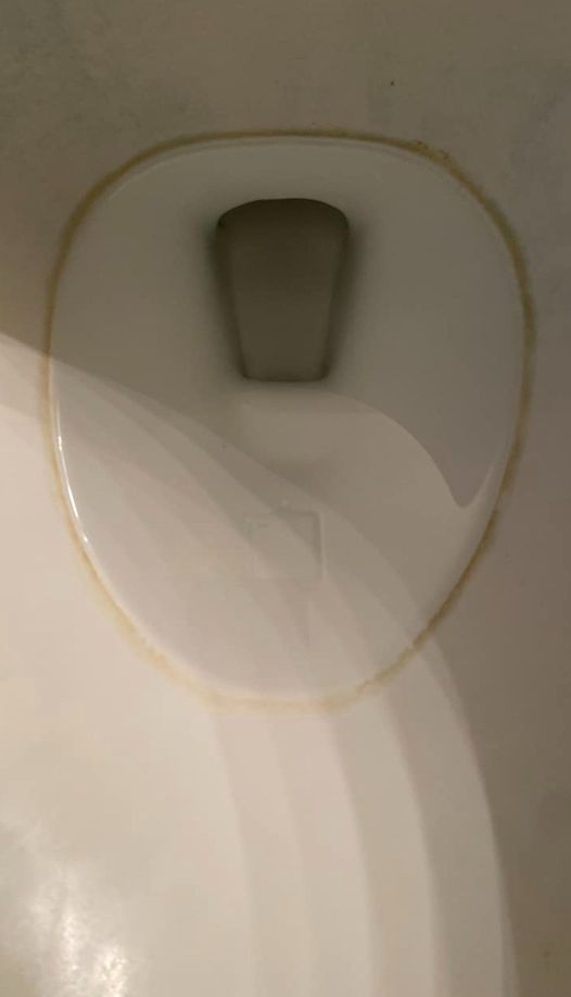 How to Get Rid of Hard Water Stains in a Toilet Bowl