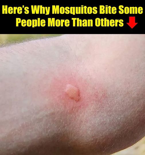 This Is Why Some People Get Bites From Mosquitoes More Often Than Others