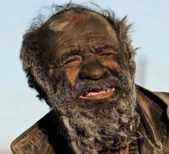 The World’s ‘Dirtiest’ Man Did Not Shower For Over 60 Years – His Reason Is Shocking