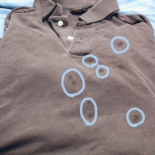 How to Remove Grease Spots from Clothing