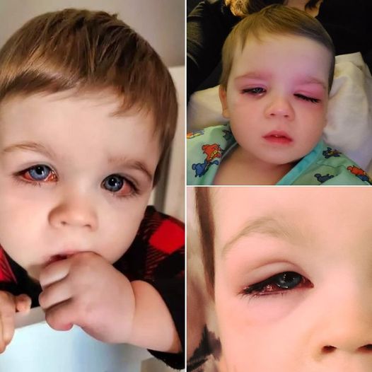 Mom issues warning after toddler nearly lost eyesight from bath toy