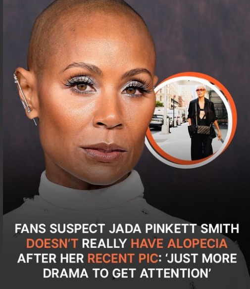 Fans Suspect Jada Pinkett Smith Has No Alopecia after Her Recent Pic: ‘Just More Drama to Get Attention’