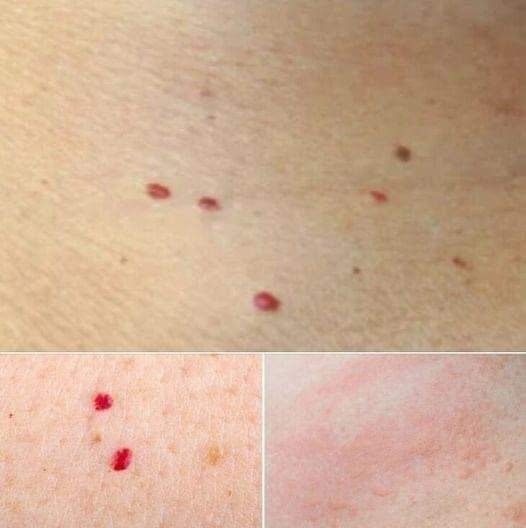 Red Dots on Your Skin: Possible Causes and Their Significance