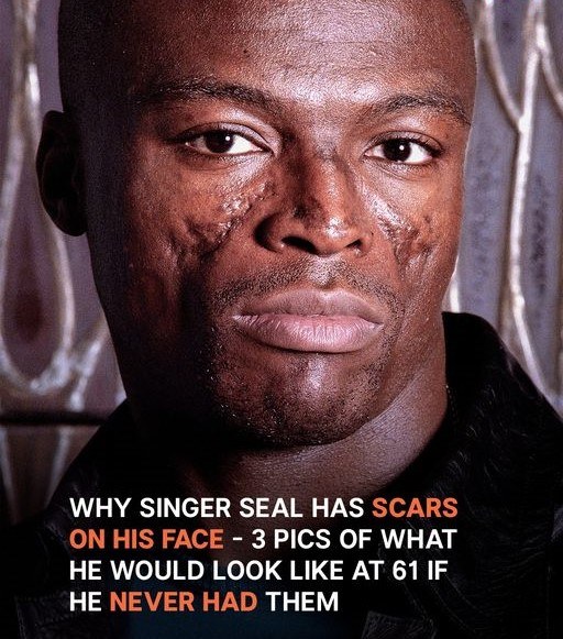 Why Singer Seal Has Scars on His Face – 3 Pics of What He Would Look Like without Them