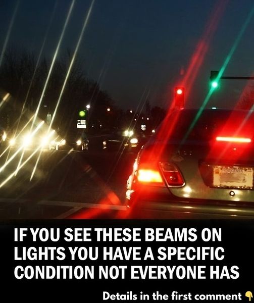 Seeing these light beams indicates that you have a particular condition that’s not common to everyone.