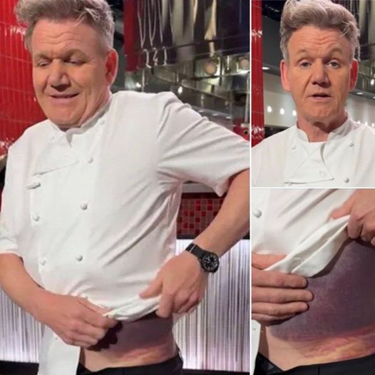 Gordon Ramsay shares important message after potentially fatal accident